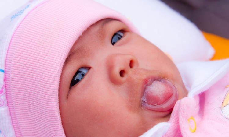 赤ちゃんの舌が白いときの体験談