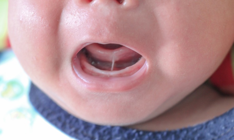 赤ちゃんの口がくさい 口臭の体験談