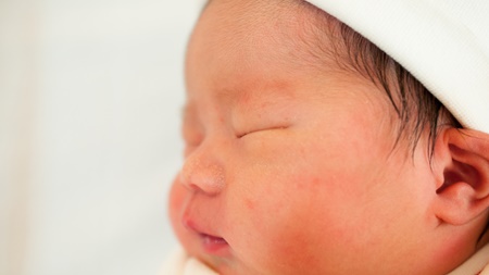 赤ちゃんの肌の特徴